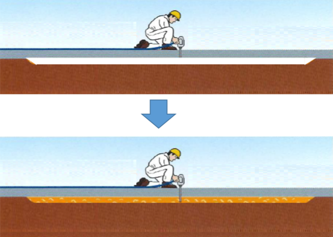 詰め物の種類には何がありますか?